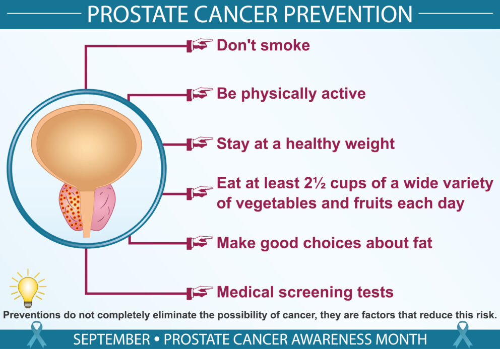 Prostate Cancer: Tips for Early Detection and Prevention